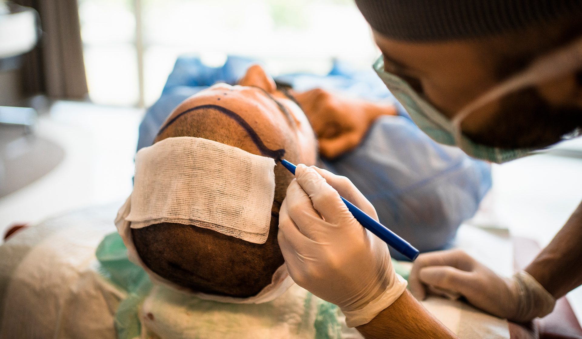 What You Need To Know Before Getting A Hair Transplant In Turkey